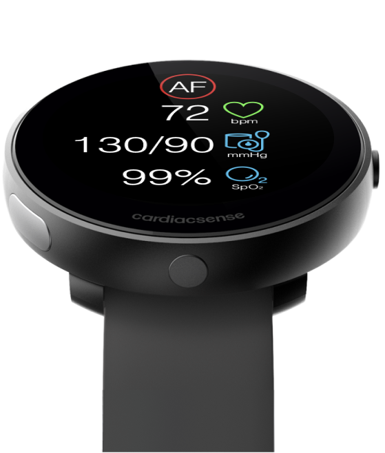 CardiacSense Smartwatch